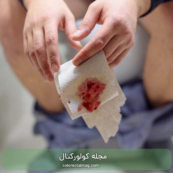 اسهال خونی نشانه چیست؟ برررسی علائم، علل و روش‌های درمان اسهال خونی