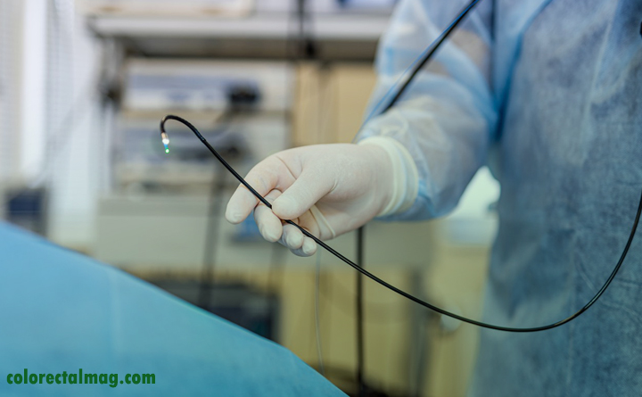 تشخیص بیماری پولیپ روده