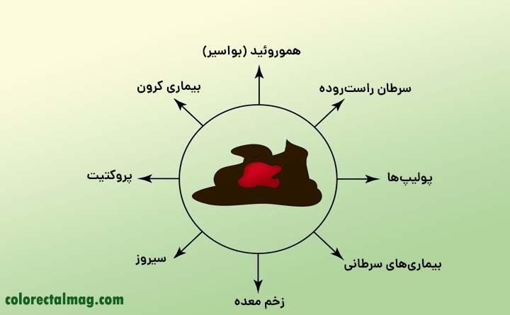 علل اسهال خونی