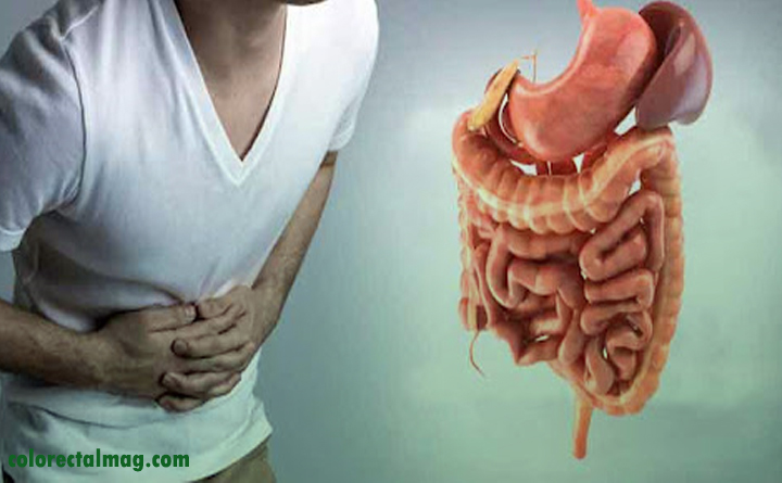 بیماری های روده خطرناکند؟