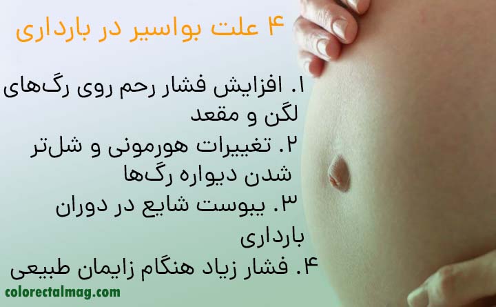  بواسیر در بارداری