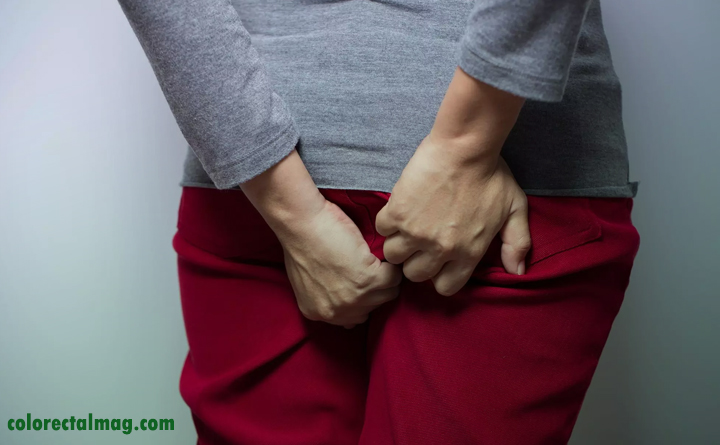 بواسیر و خارش مقعدی