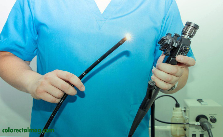 مراحل انجام کولونوسکوپی