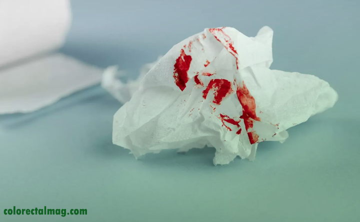 سرطان روده بزرگ