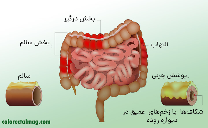 کرون چیست؟