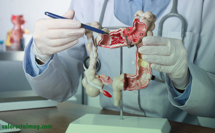 درمان بیماری های روده چگونه است