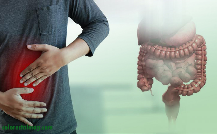 بیماری های بدخیم روده و مقعد