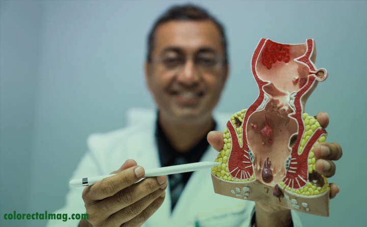 انواع عفونت های مقعدی