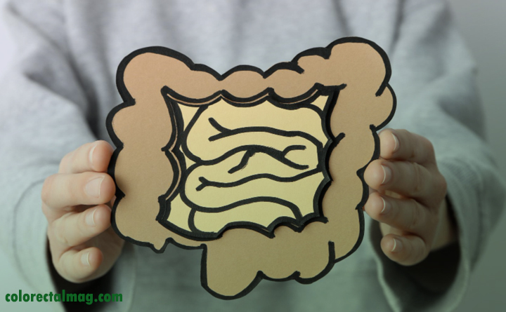 پیشگیری از خونریزی مقعدی