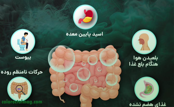دلایل زیاد شدن باد معده