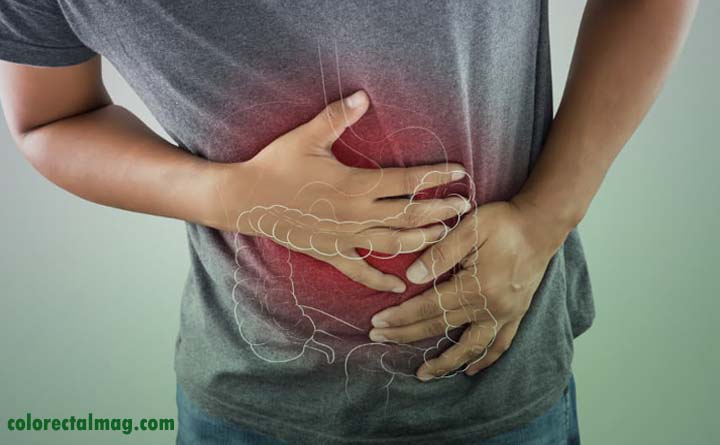 چرا کولیت روده میگیریم؟
