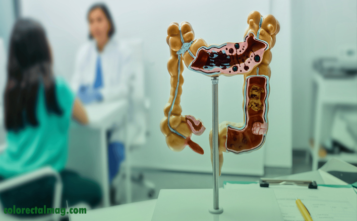 درمان پولیپ