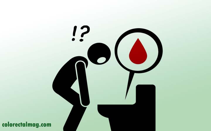 چرا اسهال خونی میگیریم؟
