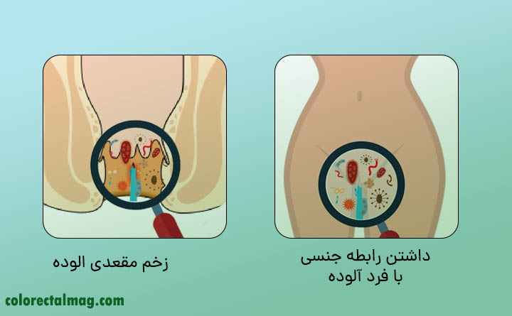 بیماری های مقعدی وعفونت