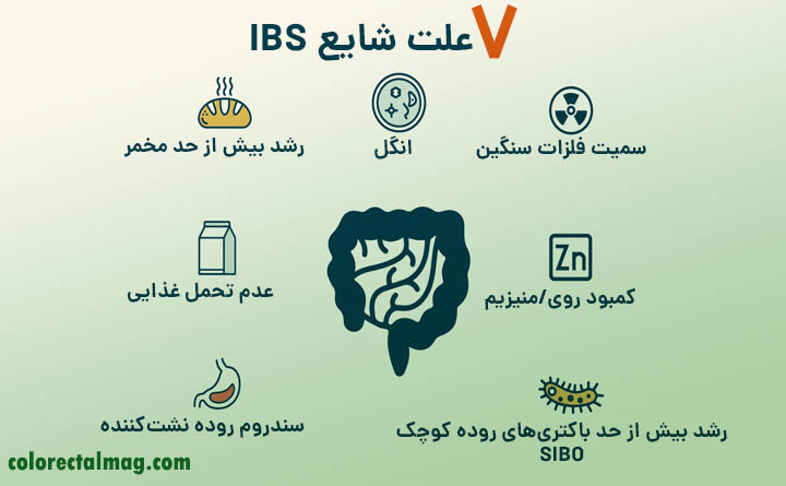 علل شایع سندروم روده تحریک پذیر