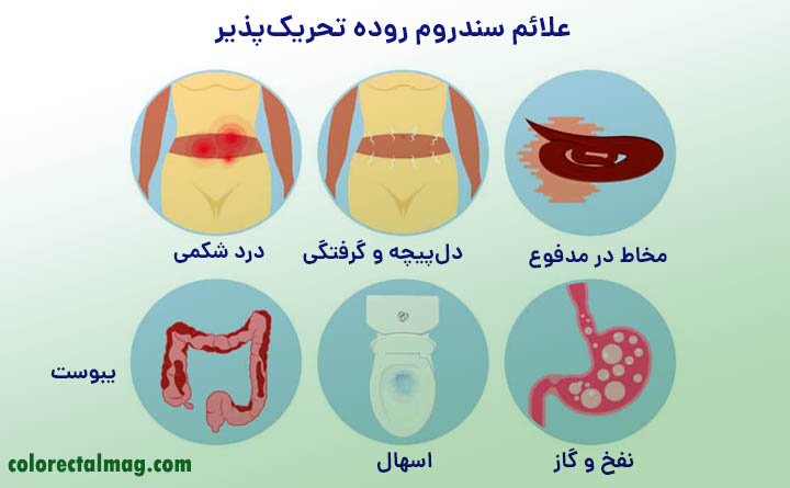 علائم IBS